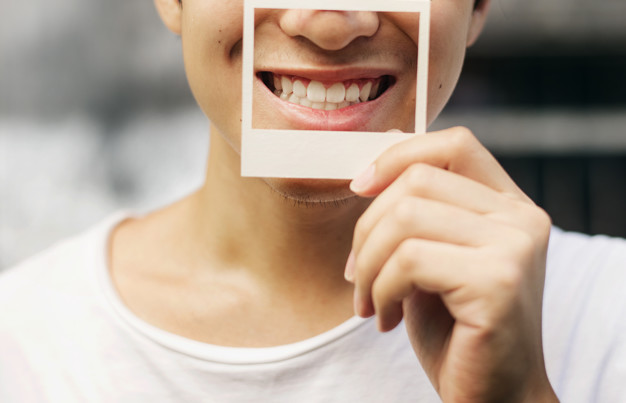 implanturi-dentare