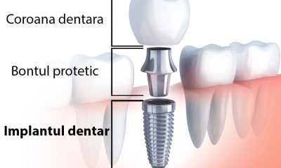 DentoCare