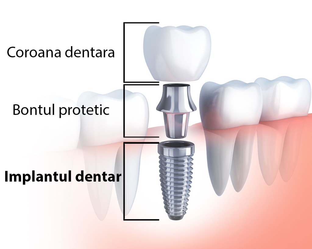 DentoCare