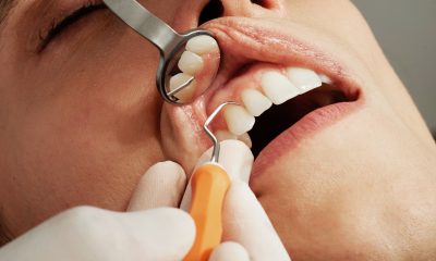 gel gingival