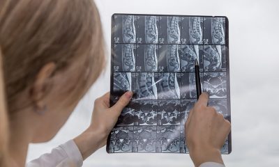 clinica de recuperare coloana vertebrala