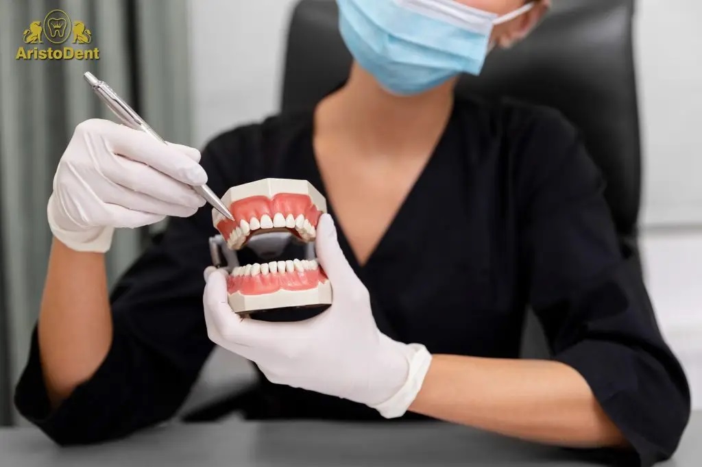 Implanturile dentare