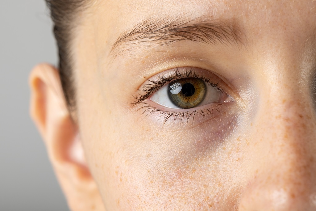 blefaroplastie cu laser